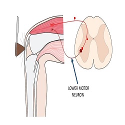 Lower motor neurons