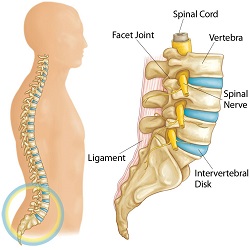 Lumbar Disk Disease (Herniated Disk)